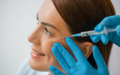 Endolift : le mini-lifting au laser qui redessine le visage sans bistouri